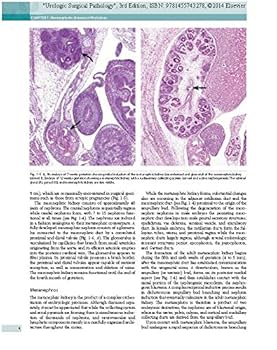 Urologic Surgical Pathology: Expert Consult - Online and